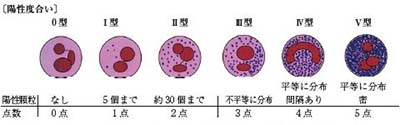 NAP染色判定法〔陽性態度と判定法・基準値〕