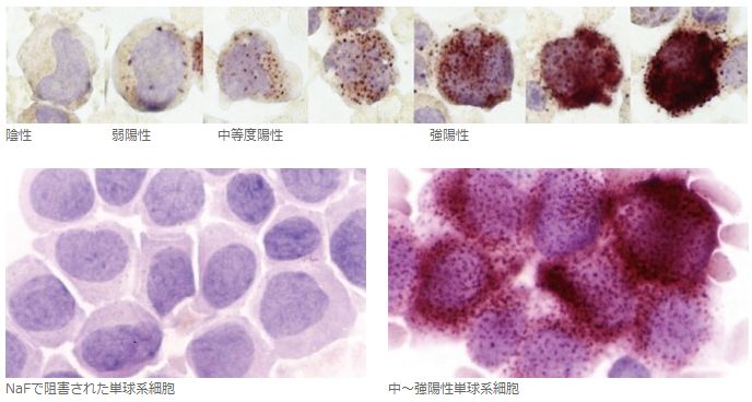 単球のα -NBE 染色種々