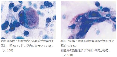 染色手順