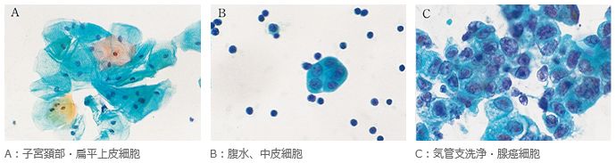 病理染色用溶剤エタノール100を用いた標本