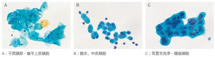 従来の試薬エタノールを用いた標本